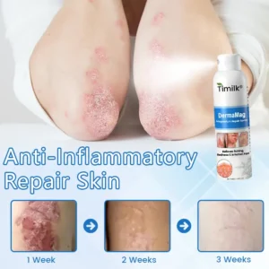 ✅ Official Store: Timilk® DermaMag Magnesium Repair Spray 🔥