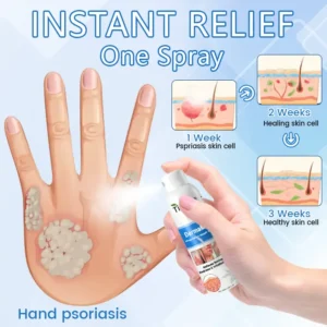 ✅ Official Store: Timilk® DermaMag Magnesium Repair Spray 🔥 FDA Certified (Clinically Proven Relief for Psoriasis, Eczema, and Chronic Skin Irritation 🌿)