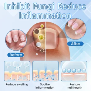 ✅ Official Store: Timilk® DermaMag Magnesium Repair Spray 🔥 FDA Certified (Clinically Proven Relief for Psoriasis, Eczema, and Chronic Skin Irritation 🌿)