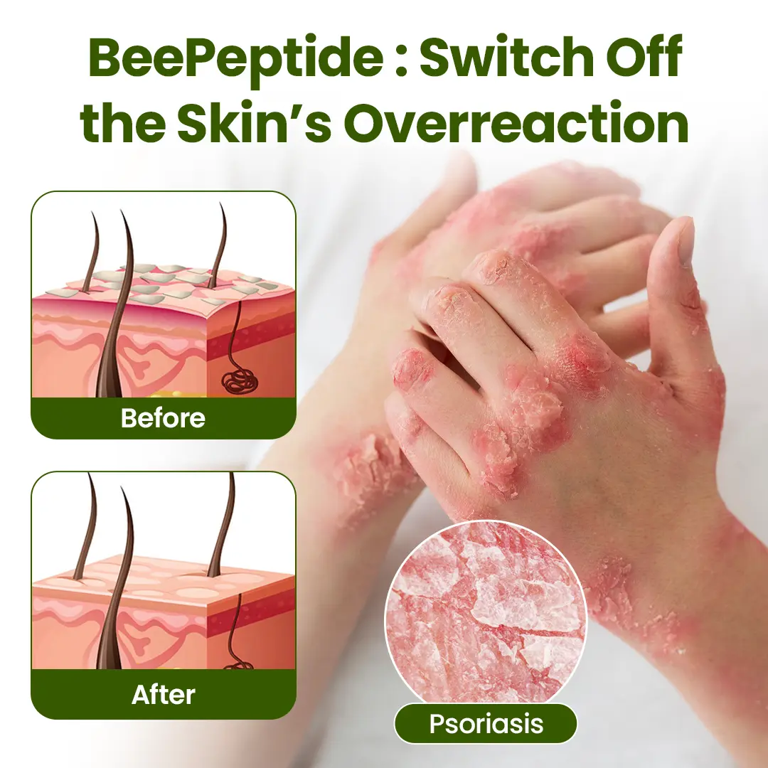 Timilk® BeePeptide RootSoft DualRelief Cream