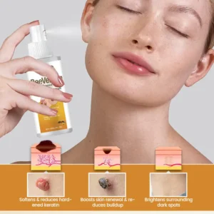 Timilk® BeeVenom Wart Renewal Spray