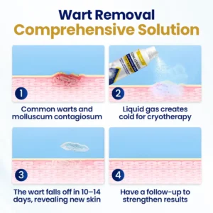 Timilk® ChillErase Bump Renewal Spray