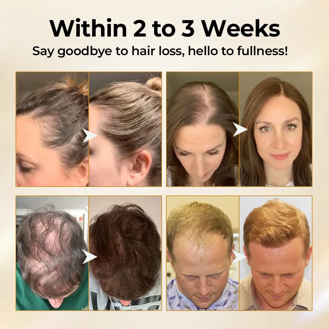 Timilk® CollagenGrow Peptides Hair Growth Spray