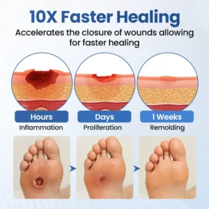 Timilk® GlucoDerm Barrier Spray