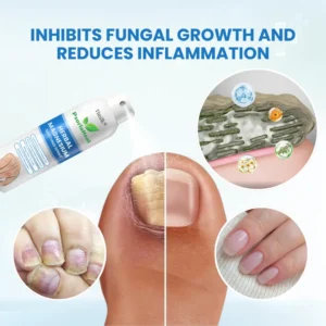 Timilk® PsoriaHeal Herbal Magnesium Soothing Spray