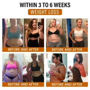 Timilk® SlimFlow Bee Venom Lymphatic Detox Foot Patches