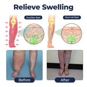 Timilk® SwellRelief Circulation Support Cream