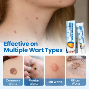 Timilk® TagGone Wart Removal Cream 🇺🇸