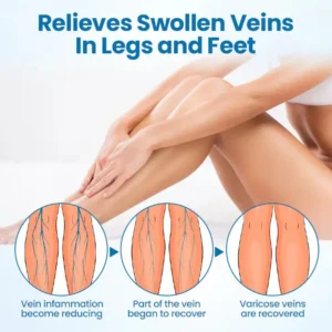 Timilk® VeinGuard Herbal Spray-✅ Clinically proven to eliminate varicose veins in just 7 days!