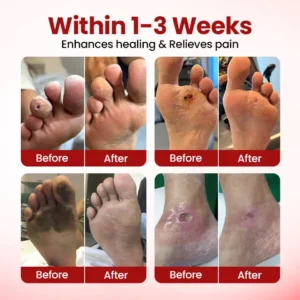 Timilk® VitaGluco Diabetic Care Cream 🇬🇧