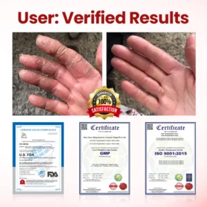 Timilk® VitaGluco Diabetic Care Cream 🇬🇧