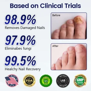 Timilk® Anti-Fungal Nail Repair Patch⭐