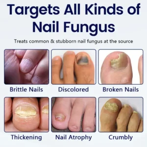 Timilk® Anti-Fungal Nail Repair Patch⭐