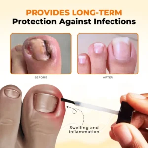 Timilk® NailRevive Bee Venom Anti-fungi Solution⭐