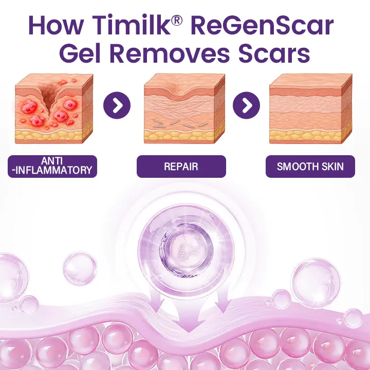 Timilk® ReGenScar Stem Cell Scar Gel