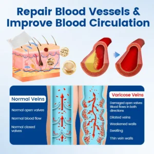 Timilk® Vein Ease Microneedle Therapy Patch🔥