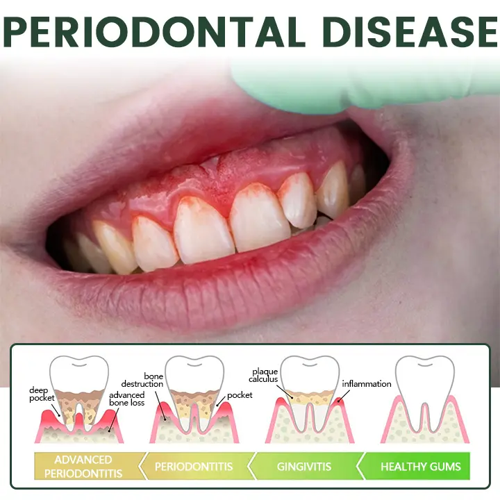Timilk® WillowBark Tooth Spray