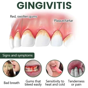 Timilk® WillowBark Tooth Spray