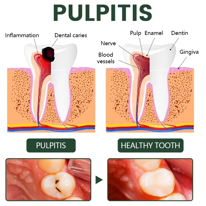 Timilk® WillowBark Tooth Spray