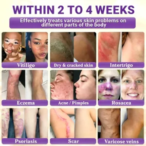 Timilk® BioColla DermaRenew Cream