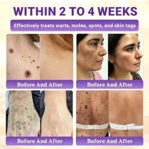 Timilk® BioColla DermaRenew Cream