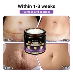 Timilk® BioColla DermaRenew Cream（usa）