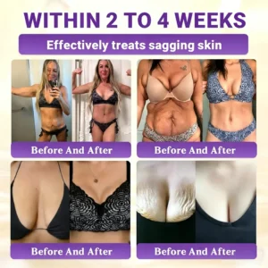 Timilk® BioColla DermaRenew Cream（usa）