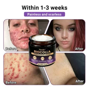 Timilk® BioColla DermaRenew Cream（usa）