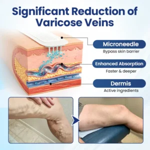 Timilk® Deep Vein Repair Microneedle Patch