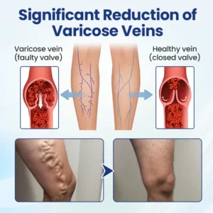 Timilk® Deep Vein Repair Microneedle Patch