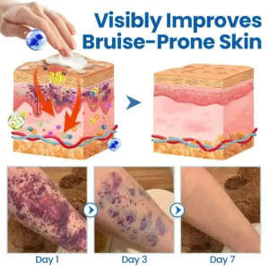 Timilk® Fragile Skin Repair Cream🛡️🌿 Multi-Repair for Bruises, Dryness & Spots