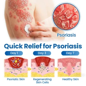 Timilk® Fragile Skin Repair Cream🛡️🌿 Multi-Repair for Bruises, Dryness & Spots