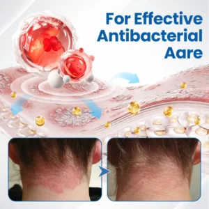 Timilk® Fragile Skin Repair Cream🛡️🌿 Multi-Repair for Bruises, Dryness & Spots