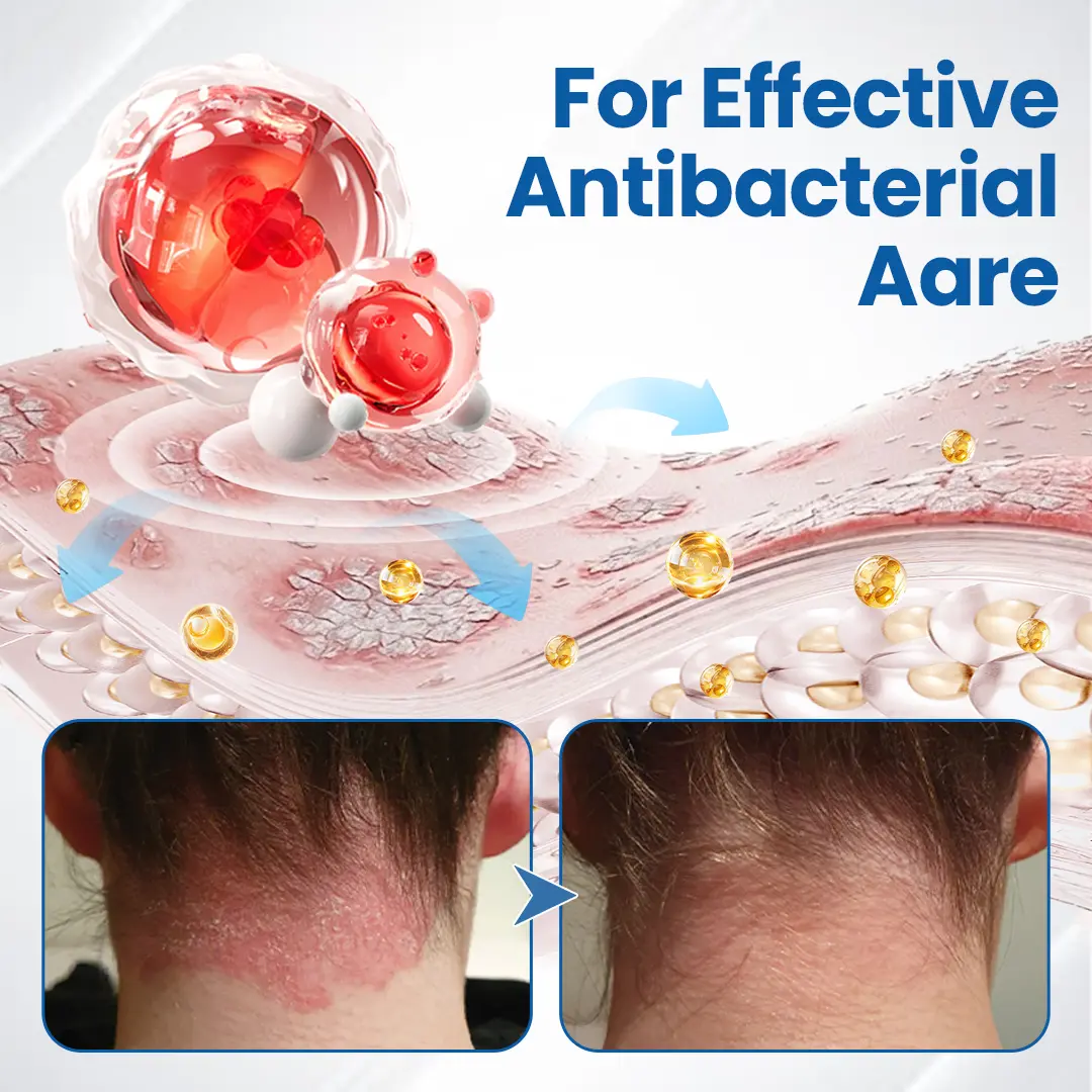 Timilk® Fragile Skin Repair Cream🛡️🌿 Multi-Repair for Bruises, Dryness & Spots