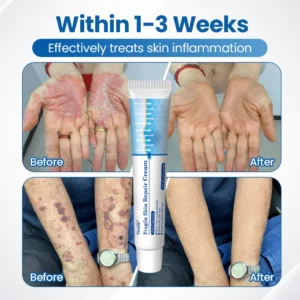Timilk® Fragile Skin Repair Cream🛡️🌿 Multi-Repair for Bruises, Dryness & Spots