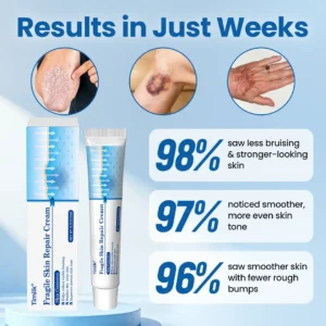 Timilk® Fragile Skin Repair Cream🛡️🌿 Multi-Repair for Bruises, Dryness & Spots