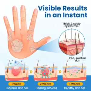 Timilk® Fragile Skin Repair Cream🛡️🌿 Multi-Repair for Bruises, Dryness & Spots