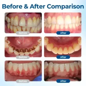 Timilk® GumHoney Oral Repair Drops