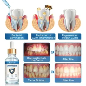 Timilk® GumHoney Oral Repair Drops